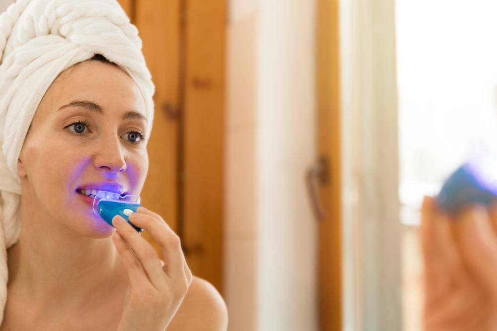Comment se blanchir les dents à domicile ?-1