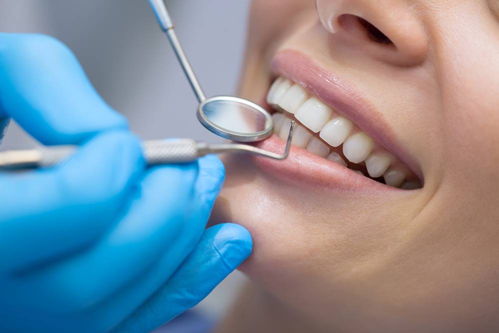 Comment se déroule un blanchiment dentaire chez le dentiste ?-2