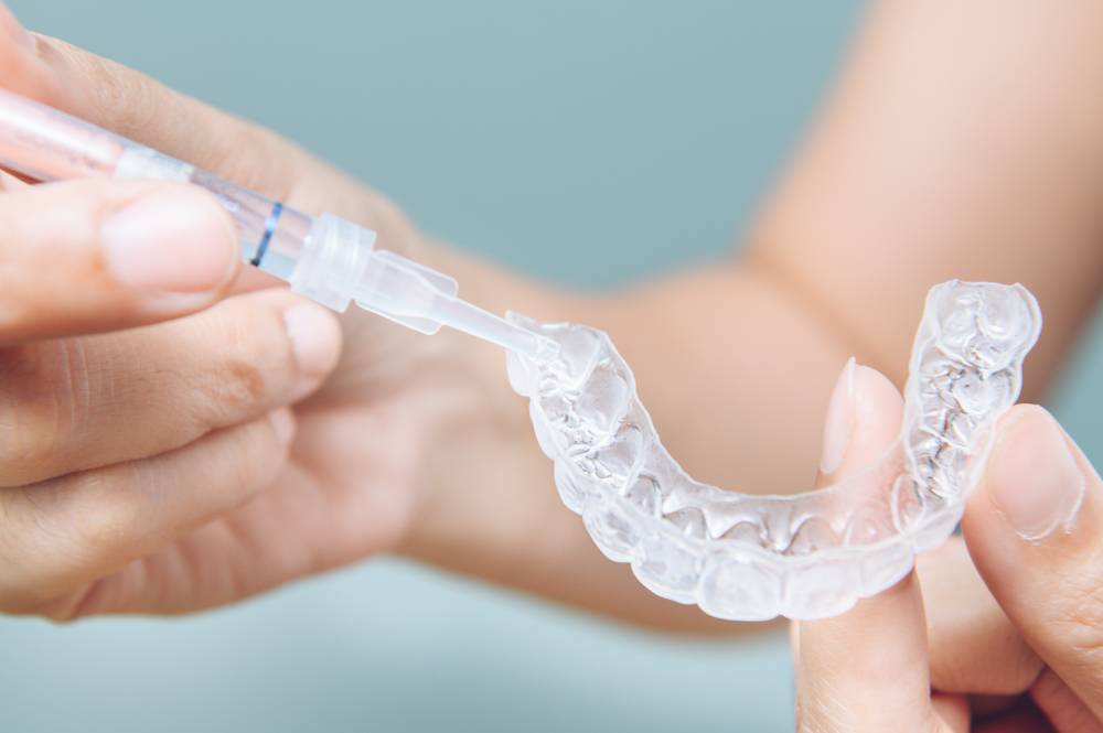 Quels sont les meilleurs gels de blanchiment dentaire ?-1