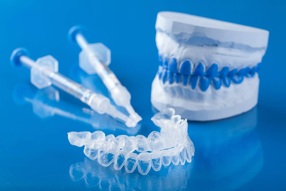 Quels sont les meilleurs kits de blanchiment dentaire ?-1