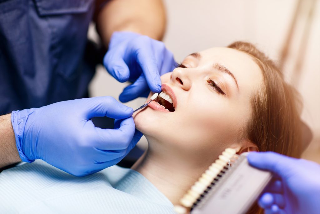 Quel est le prix d’un blanchiment dentaire ?